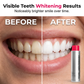 😁50K+ SOLD!🦷40% OFF! ☕Stain‑Removing Whitening Mouthwash – Lifts coffee & tea stains, alcohol‑free. Instant gunk binding, long‑lasting minty fresh. Gentle enough for daily use. 🦷